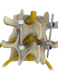 CT-to-fluoroscopy registration versus scan-and-plan registration for robot-assisted insertion of lumbar pedicle screws