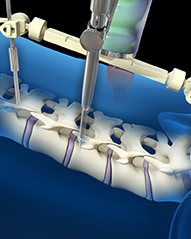 robot cohorts in robot-assisted spine surgery